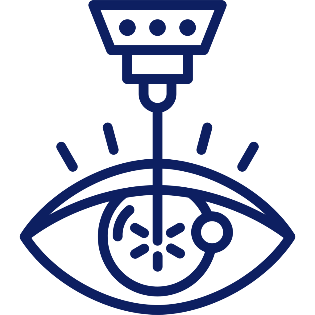 illustration of eye surgery